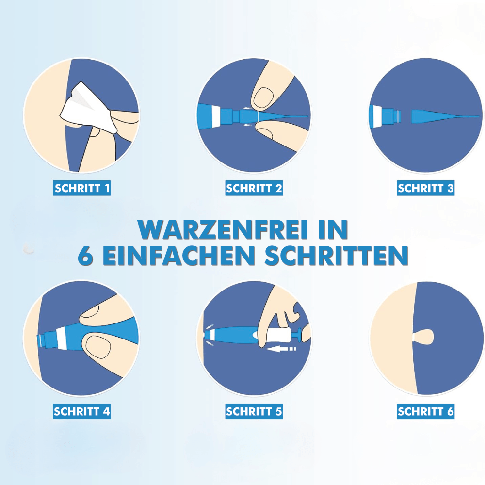 Warzenfrei PRO - Der Professionelle Stielwarzen Entferner