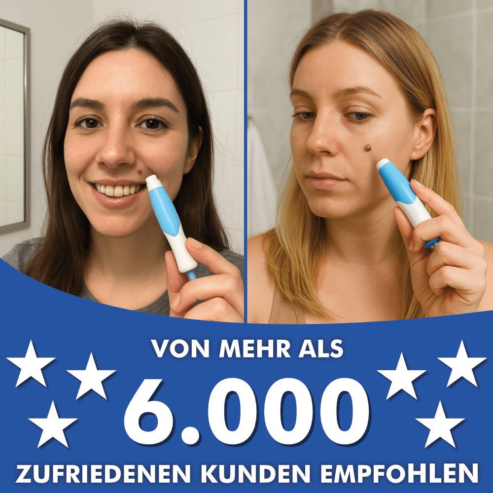 Warzenfrei PRO - Der Professionelle Stielwarzen Entferner