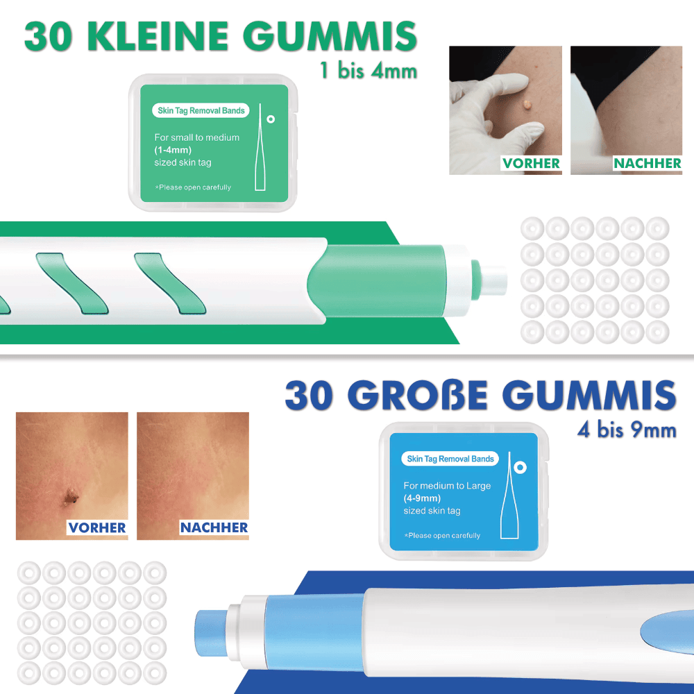 Warzenfrei PRO Bundle - GRATIS Warzenfrei + E-Book