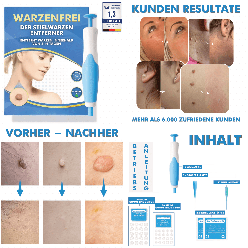 Warzenfrei PRO Bundle - GRATIS Warzenfrei + E-Book