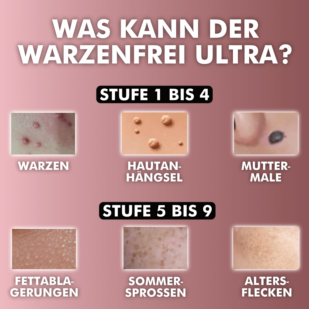 Warzenfrei ULTRA - Der Ultimative Warzen- & Muttermalentferner