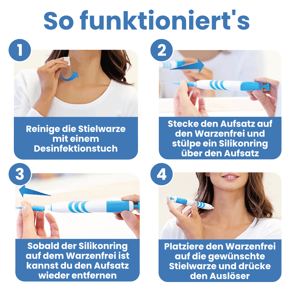 Warzenfrei - Der Stielwarzen Entferner