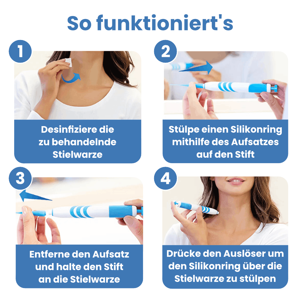 Warzenfrei - Der Stielwarzen Entferner