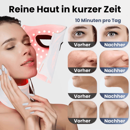 Porenrein - Die Lichttherapie-Gesichtsmaske